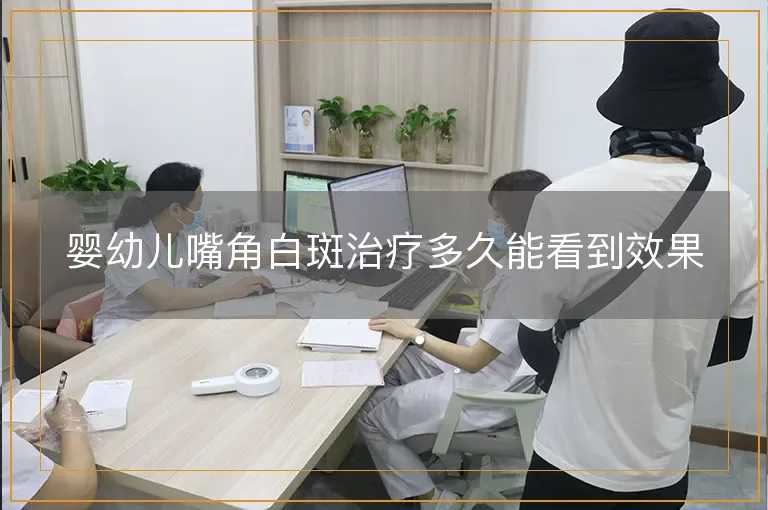 婴幼儿嘴角白斑治疗多久能看到效果