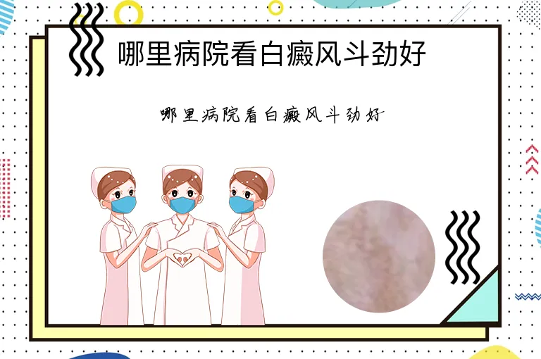 哪里病院看白癜风斗劲好