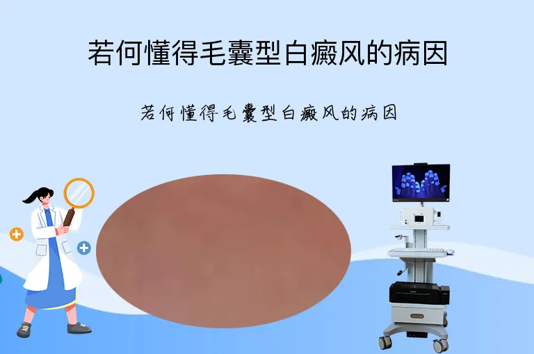 若何懂得毛囊型白癜风的病因