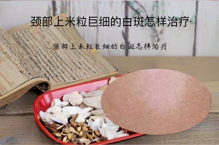 颈部上米粒巨细的白斑怎样治疗
