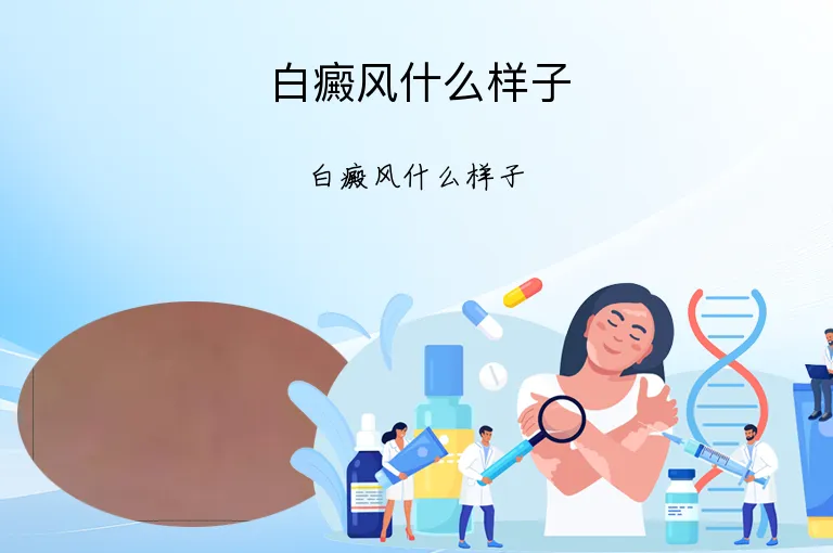 白癜风什么样子