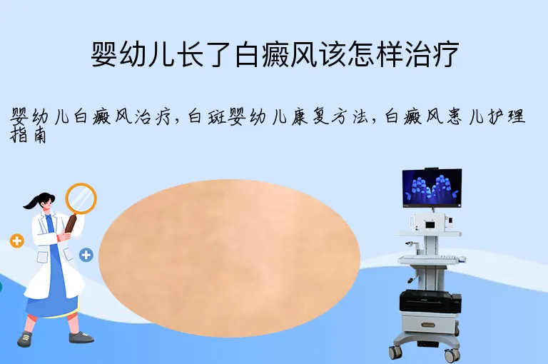 婴幼儿长了白癜风该怎样治疗