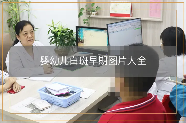 婴幼儿白斑早期图片大全