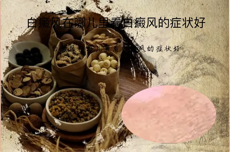 白癜风在哪儿里看白癜风的症状好