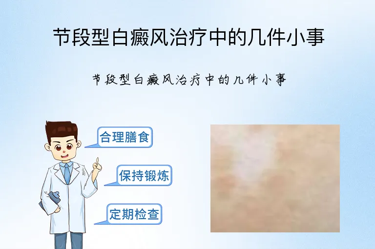 节段型白癜风治疗中的几件小事