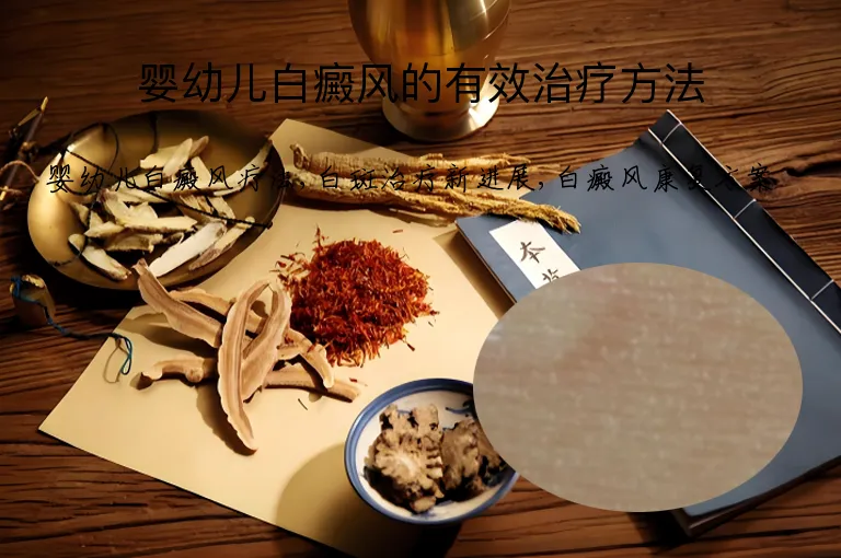 婴幼儿白癜风的有效治疗方法
