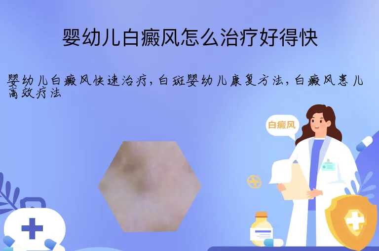 婴幼儿白癜风怎么治疗好得快