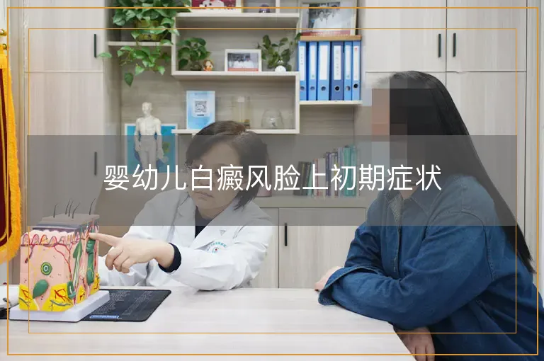 婴幼儿白癜风脸上初期症状