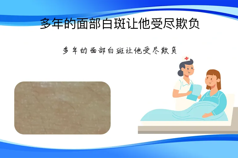 多年的面部白斑让他受尽欺负