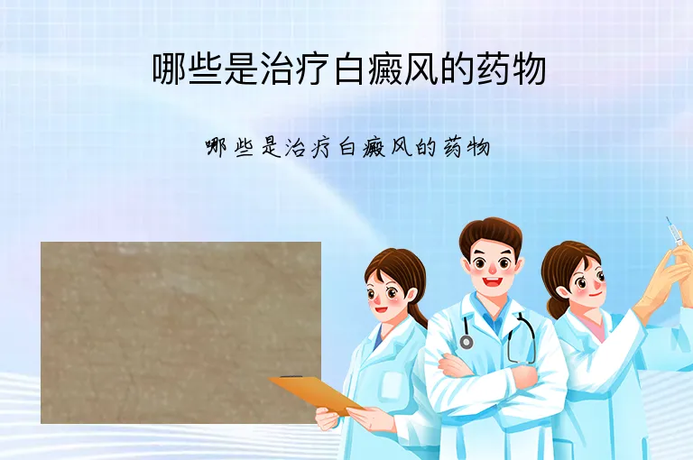 哪些是治疗白癜风的药物