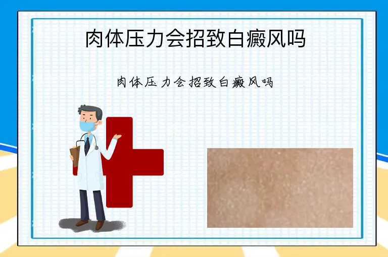肉体压力会招致白癜风吗