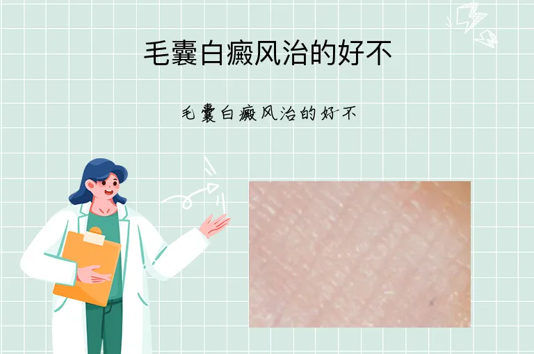 毛囊白癜风治的好不