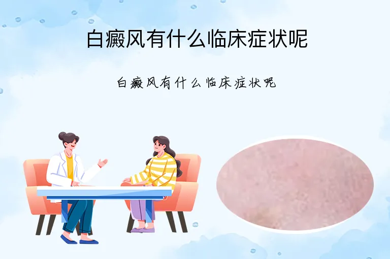白癜风有什么临床症状呢