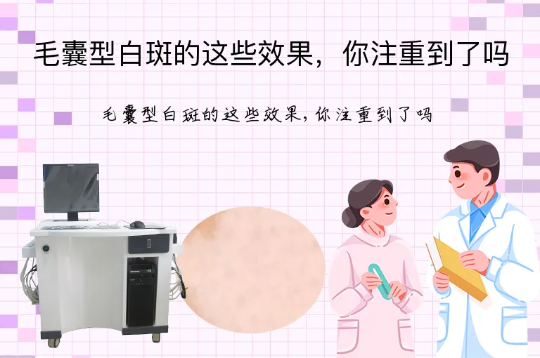 毛囊型白斑的这些效果，你注重到了吗