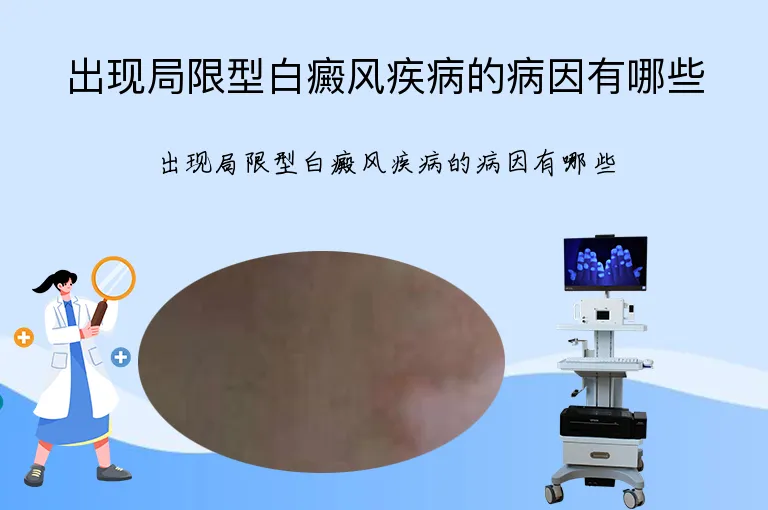 出现局限型白癜风疾病的病因有哪些