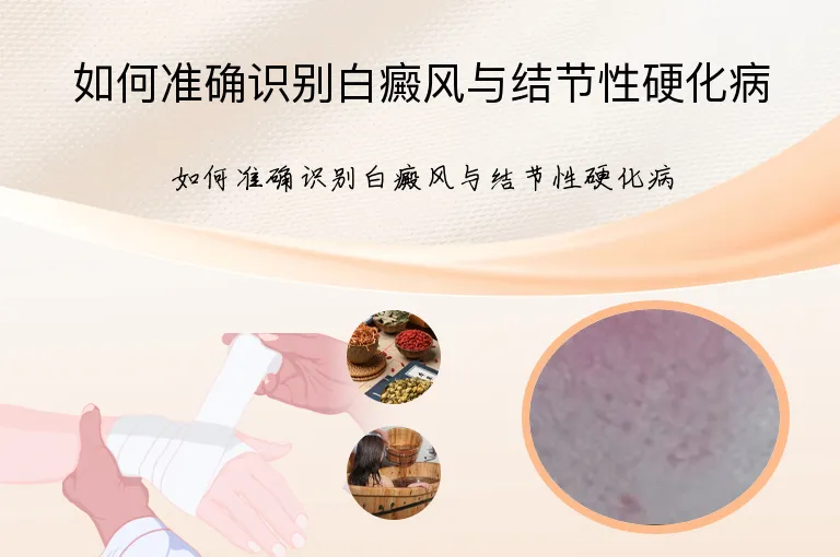 如何准确识别白癜风与结节性硬化病