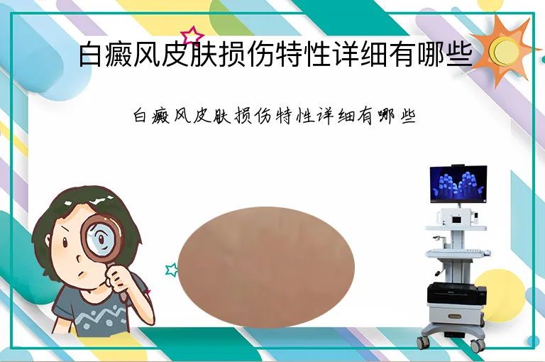 白癜风皮肤损伤特性详细有哪些