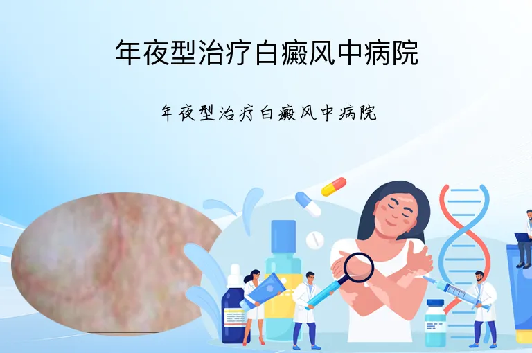 年夜型治疗白癜风中病院
