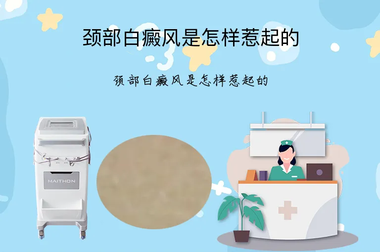颈部白癜风是怎样惹起的