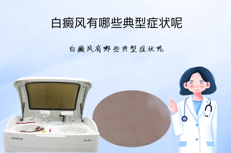 白癜风有哪些典型症状呢