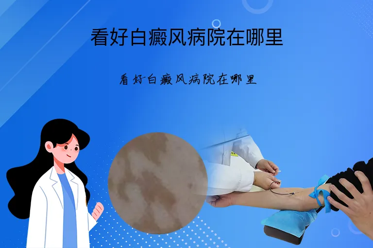 看好白癜风病院在哪里