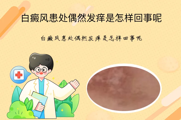 白癜风患处偶然发痒是怎样回事呢