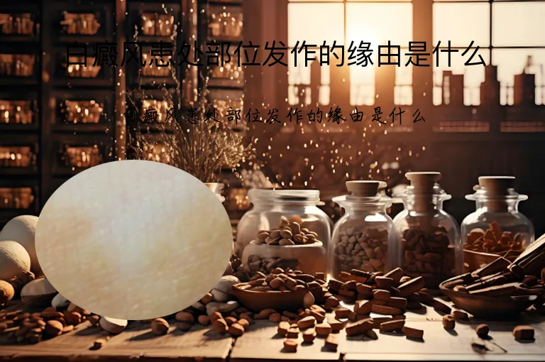 白癜风患处部位发作的缘由是什么