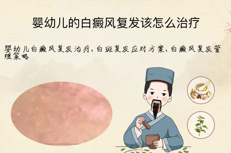 婴幼儿的白癜风复发该怎么治疗