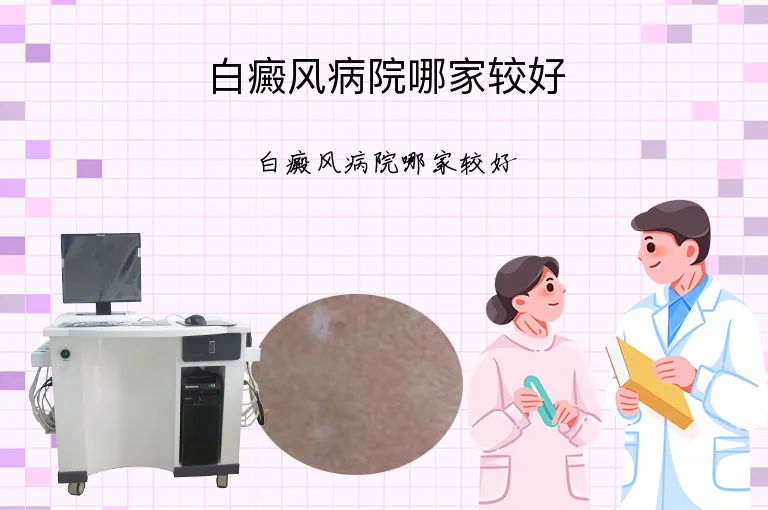 白癜风病院哪家较好