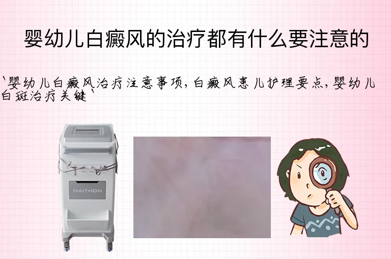 婴幼儿白癜风的治疗都有什么要注意的