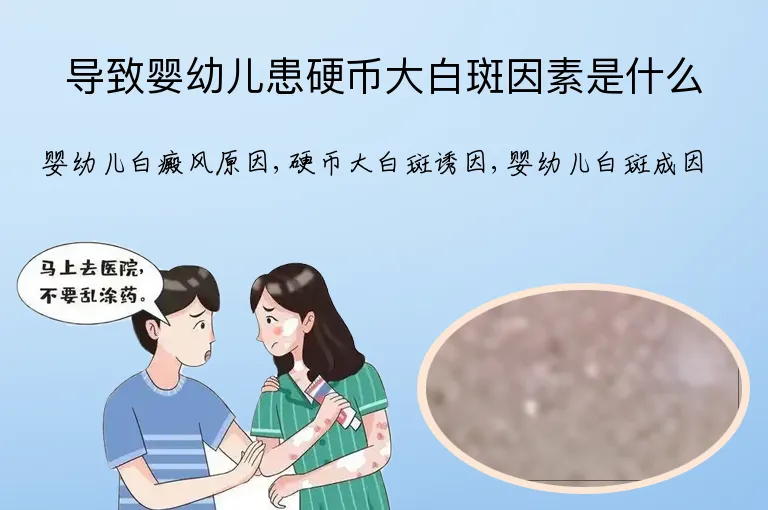 导致婴幼儿患硬币大白斑因素是什么