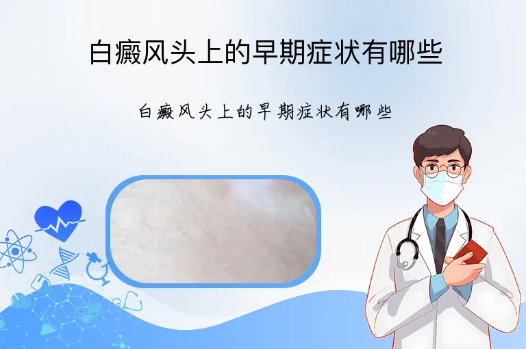白癜风头上的早期症状有哪些