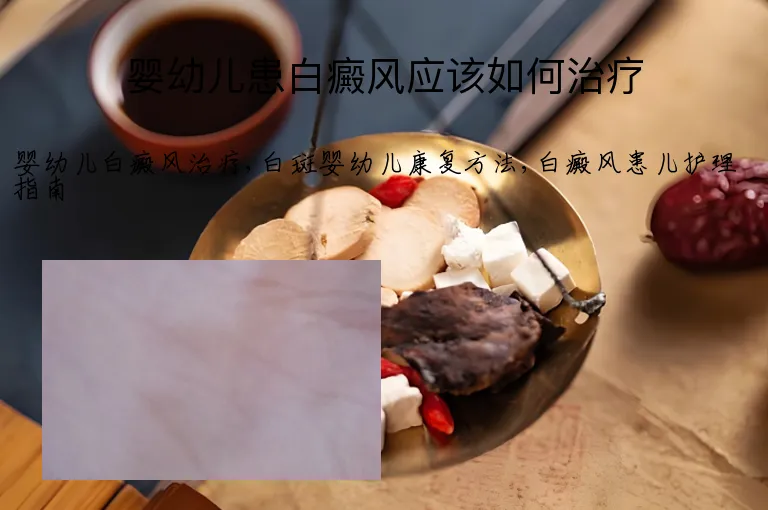 婴幼儿患白癜风应该如何治疗