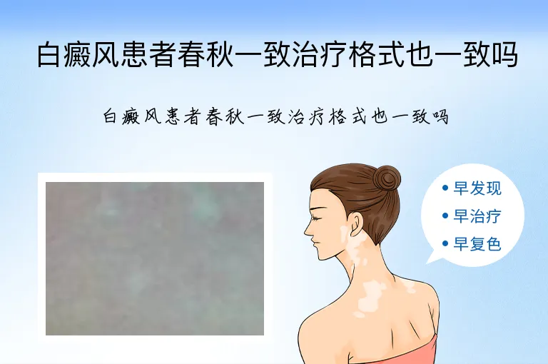 白癜风患者春秋一致治疗格式也一致吗