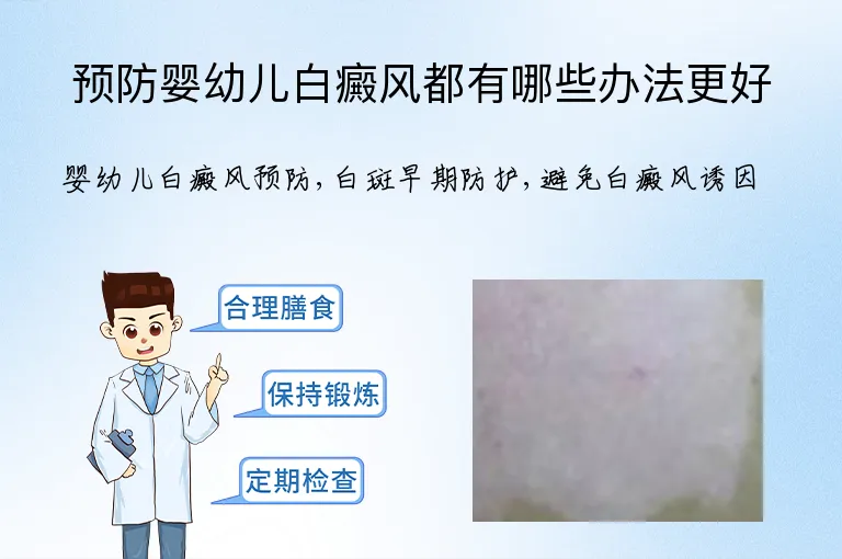 预防婴幼儿白癜风都有哪些办法更好