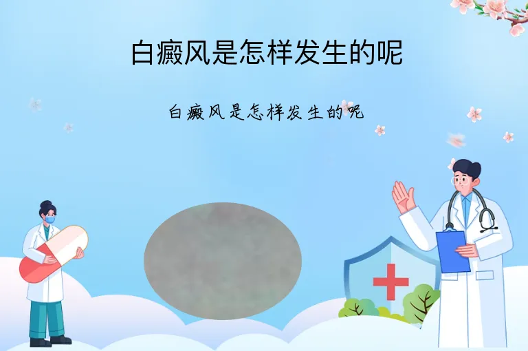 白癜风是怎样发生的呢