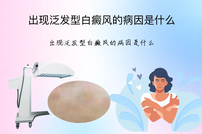 出现泛发型白癜风的病因是什么