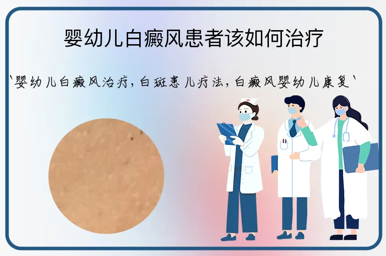 婴幼儿白癜风患者该如何治疗