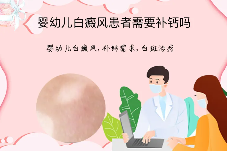 婴幼儿白癜风患者需要补钙吗