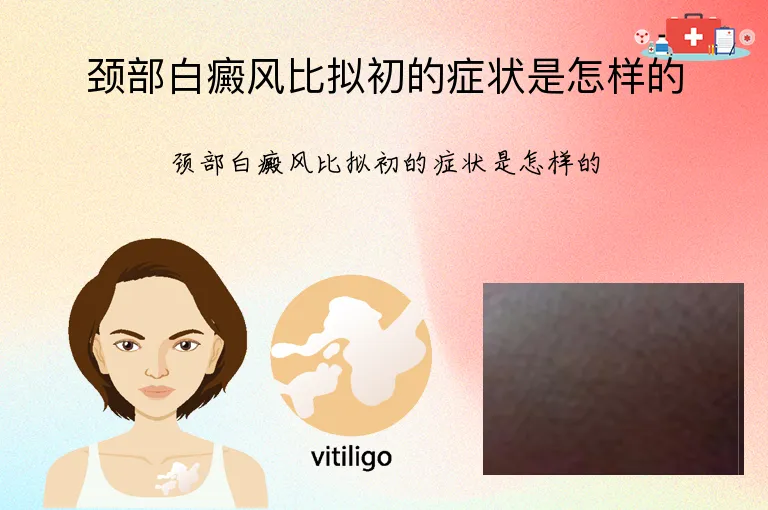 颈部白癜风比拟初的症状是怎样的