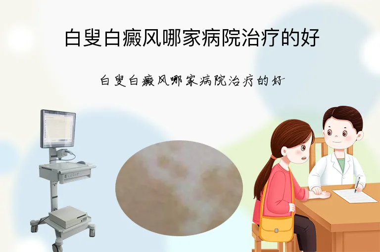 白叟白癜风哪家病院治疗的好