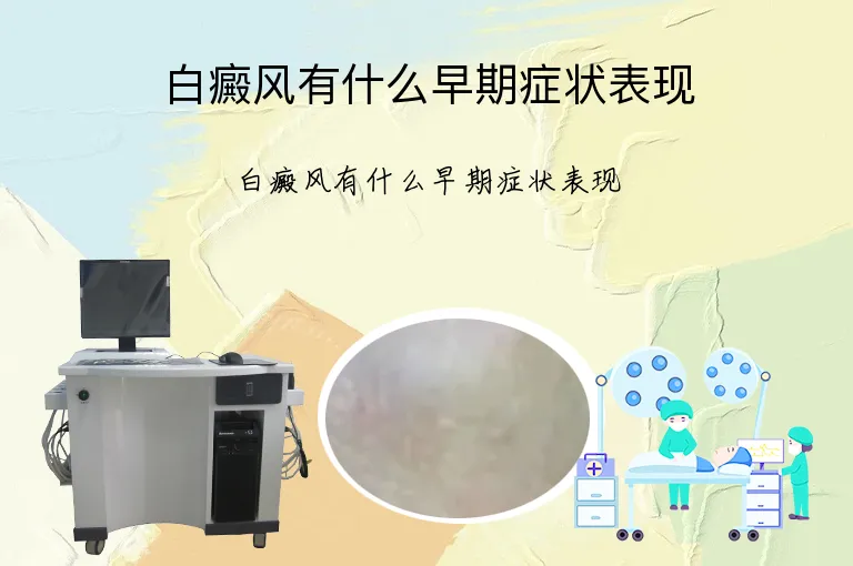 白癜风有什么早期症状表现