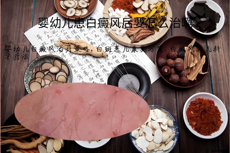婴幼儿患白癜风后要怎么治啊