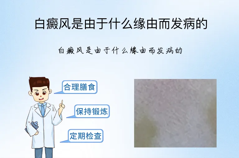 白癜风是由于什么缘由而发病的