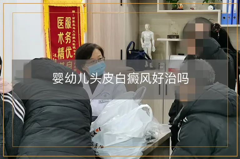 婴幼儿头皮白癜风好治吗