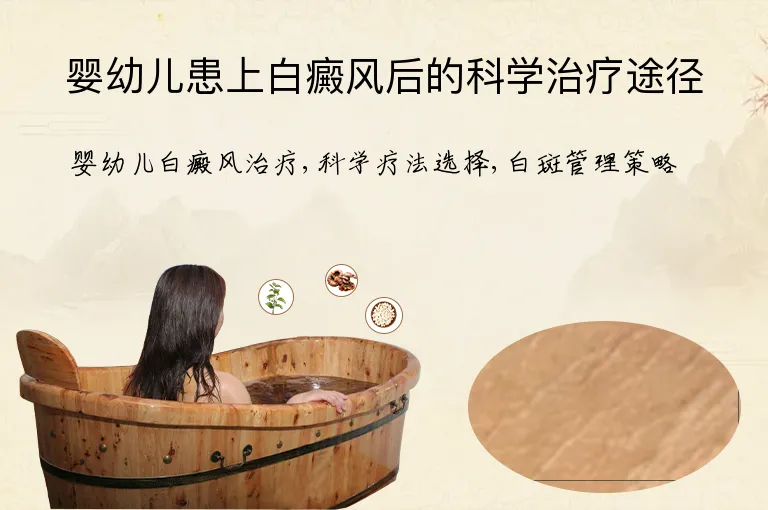 婴幼儿患上白癜风后的科学治疗途径