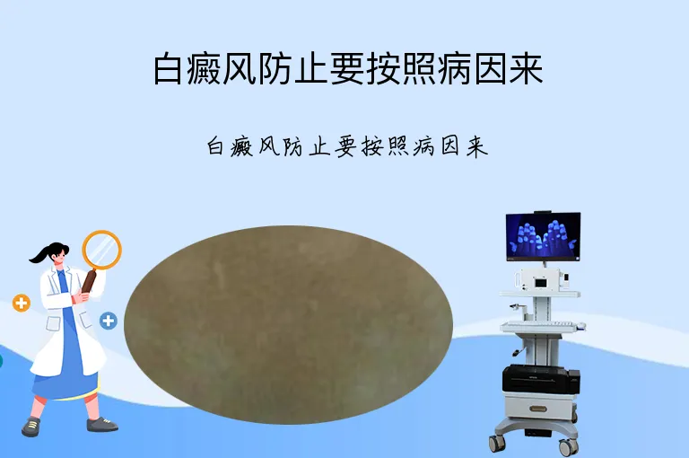 白癜风防止要按照病因来