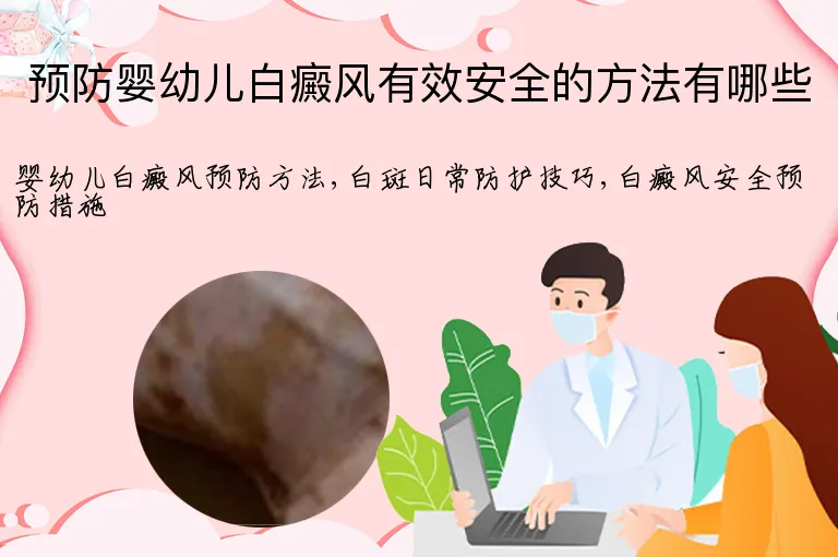 预防婴幼儿白癜风有效安全的方法有哪些