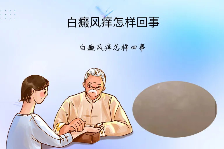 白癜风痒怎样回事