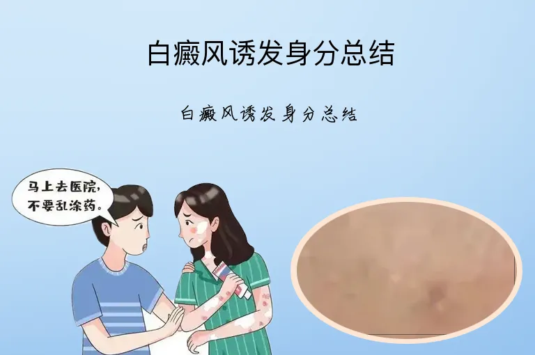 白癜风诱发身分总结